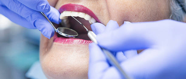 Best Emergency Treatment for Dental Infections or Abscesses in Big Pine, CA